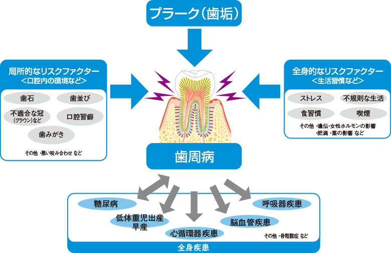 手遅れになる前に 歯周病セルフチェック 南茨木うがじん歯科 茨木市の歯医者 阪急南茨木駅すぐ